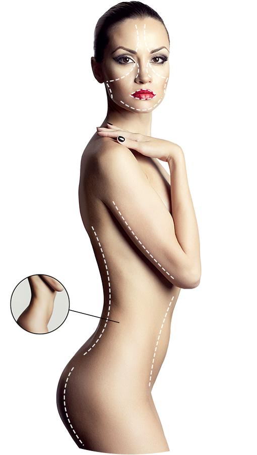 Liposuction Ico