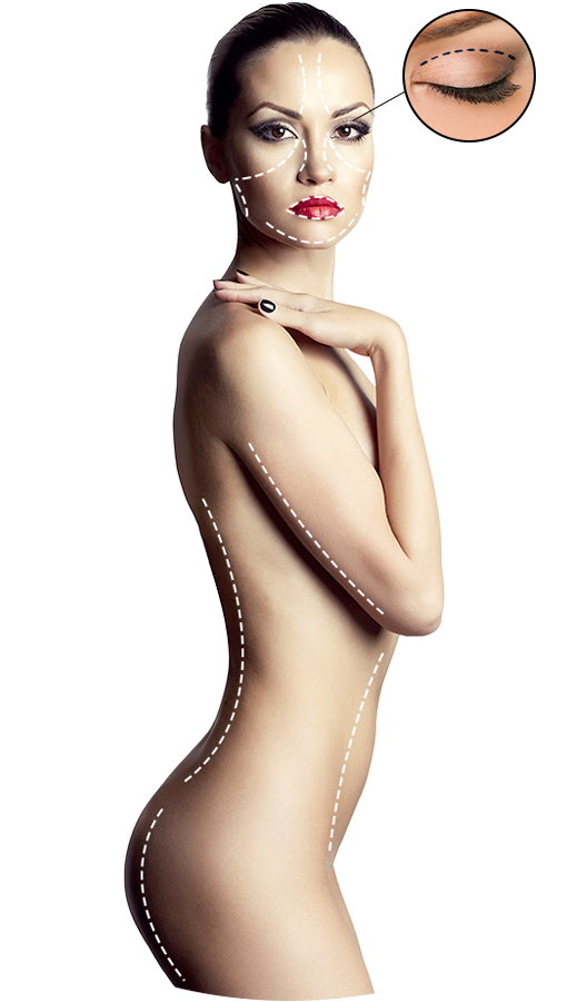 Goz Kapagi Estetigi Cat