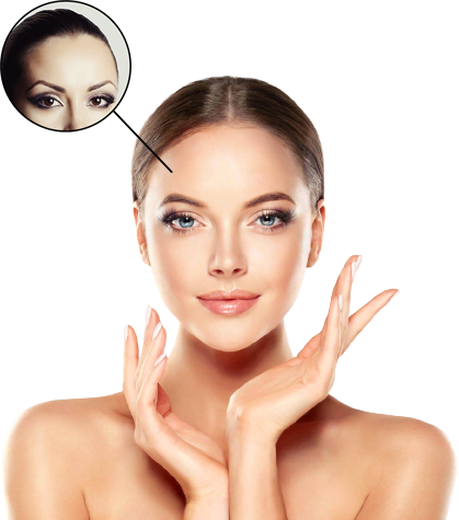 Alin Sakak Dolgusu Ico